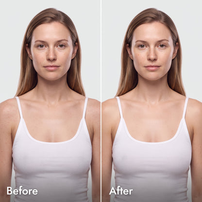 Zovura Smooth & Bright BHA Body Serum
